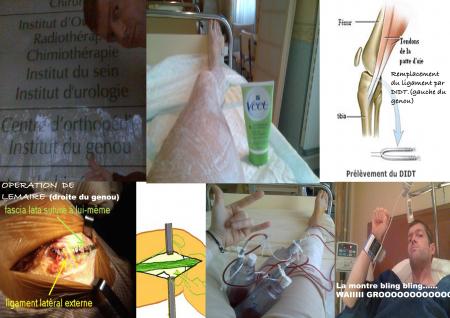 Jambe en mousse 's news.......